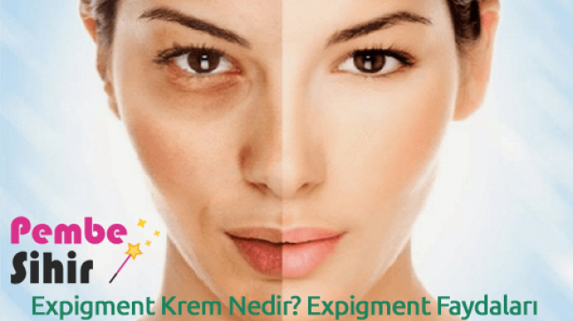 Expigment Krem Yan Etkileri Neler?